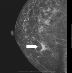 Mammographie - Centre de Mammographie et de Dépistage des maladies ...